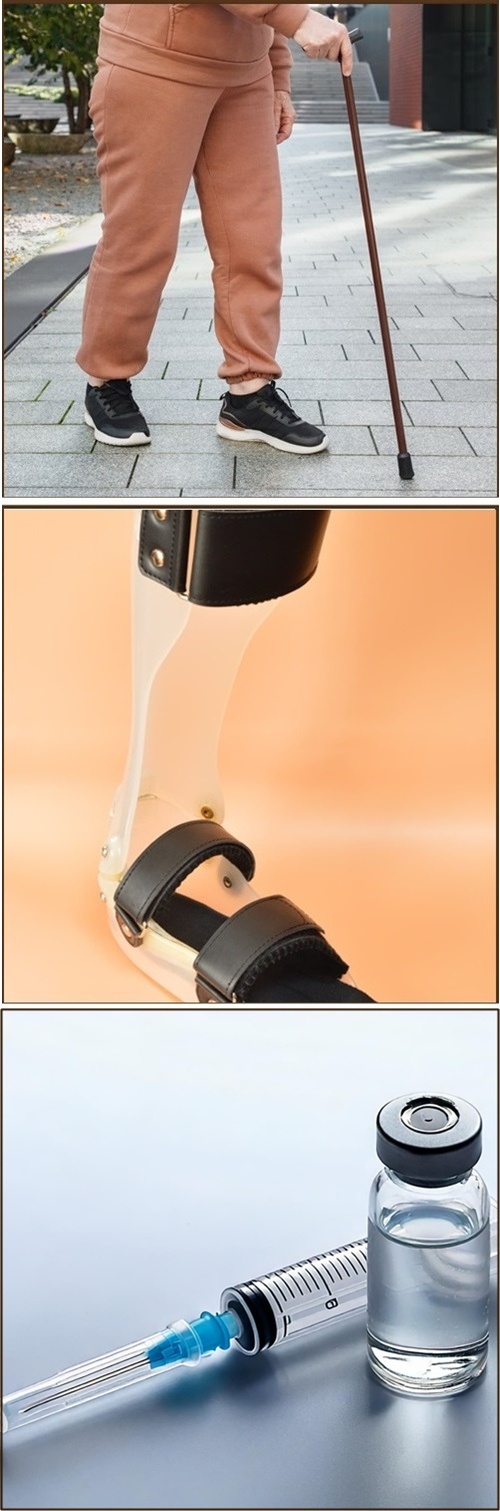 整形疾患 脳血管・変性疾患